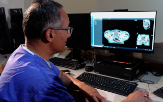微软用 AI 缩短癌症放疗时间：扫描速度提高 2.5 倍，准确率达 90%