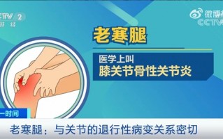 不穿秋裤不会引发“老寒腿” 医生科普真相