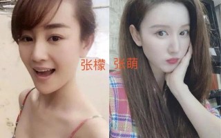 张檬整容记图片 判若两人