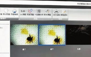 长春6岁男孩头疼医生从他头顶取出一只蜱虫（蜱虫会飞吗）