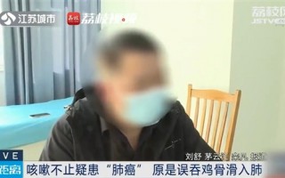 男子咳嗽不止疑似患肺癌：经诊断后竟是鸡骨滑入肺