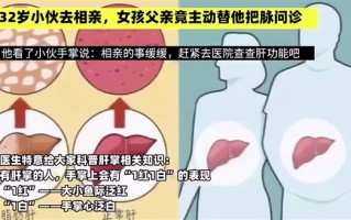 男子相亲被女方父亲发现有肝病 相亲暂缓网友称值得：医生科普肝掌知识