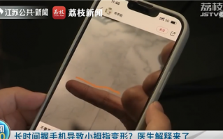 你的小拇指变形了吗？医生提醒：握手机要勤换姿势