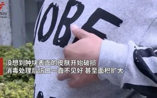 我得了乳腺癌？可我是男的啊！