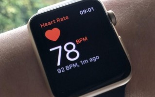 国外用户通过 Apple Watch 的 ECG 功能发现房颤，医生确诊