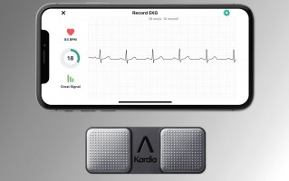 苹果在与 AliveCor 的法律战中获胜，后者多项专利被宣布无效