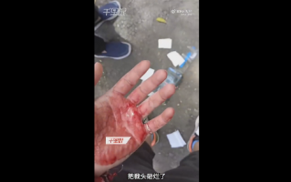 男子被高抛手机盒砸中满头血 不需要赔偿但必道歉：网友怒斥素质差还违法